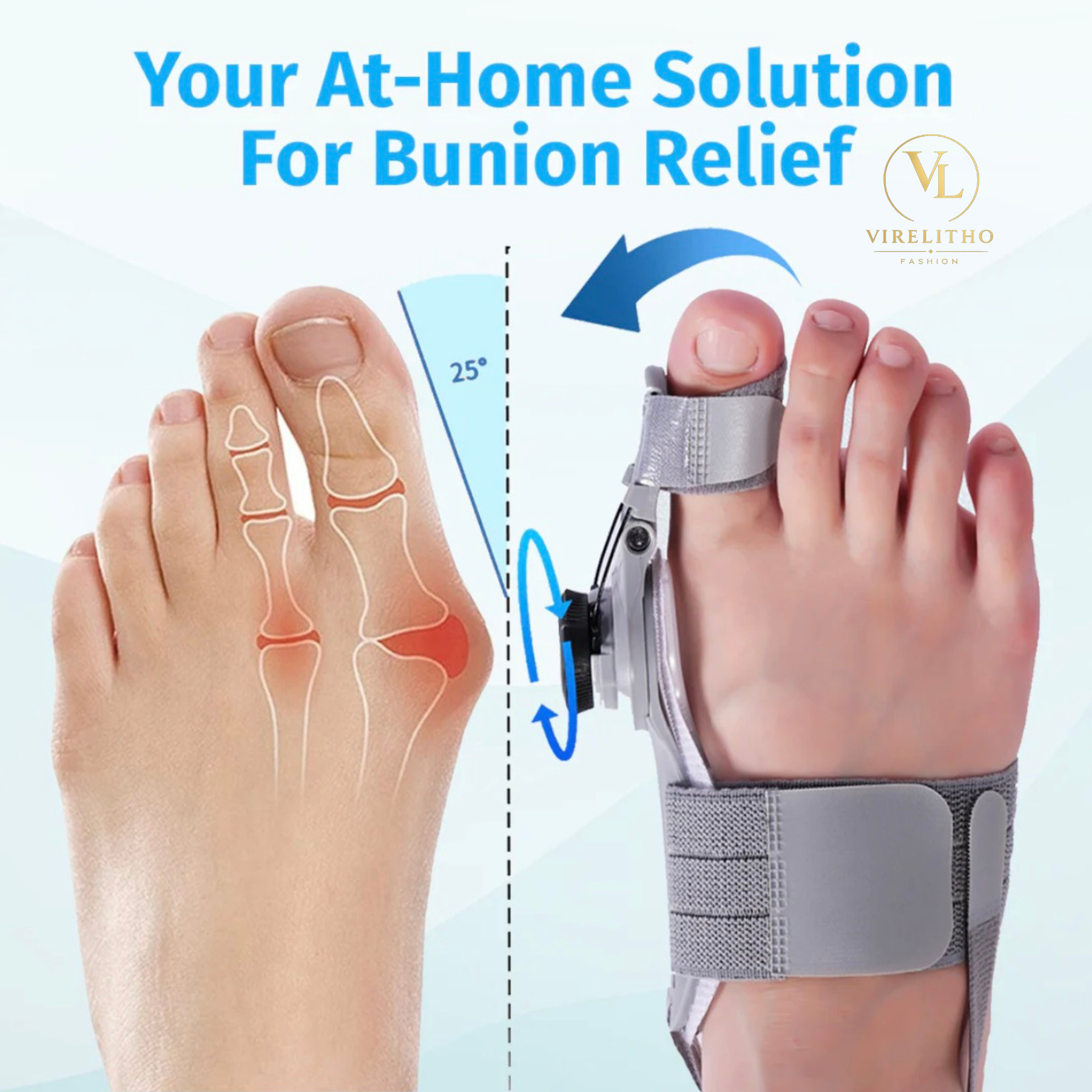Virelitho Bunion Fix