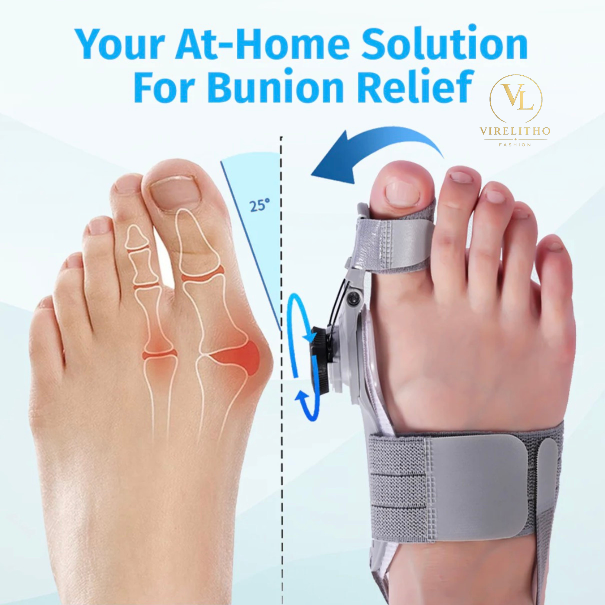 Virelitho Bunion Fix